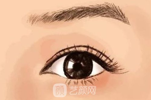 金国华双眼皮修复成果图展示｜成果自然美观