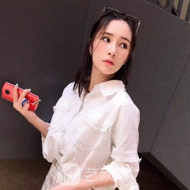 海南瑞韩整形医院割双眼皮怎么样?2023体验实例展示