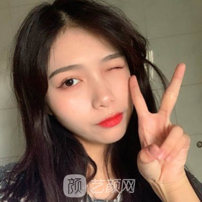 北京十优整形医院电波拉皮实例曝光｜内附亲身体验感悟