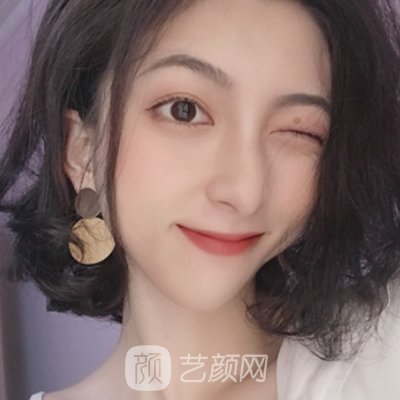 北京熙朵医疗美容医院正规吗？2023发际线种植实例曝光