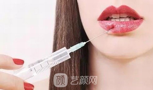 乔雅登丰颜和极致区别，哪个更好一些？