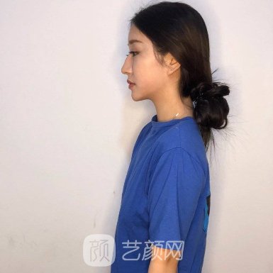 上海容妍医疗美容医院口碑好吗?2023隆胸实例公开