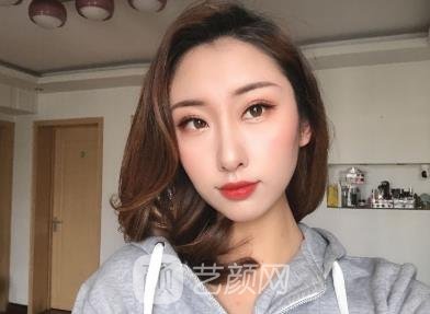 柳大烈教授手术怎么样？医生详细简介+颧骨内推实例