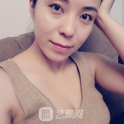 贵阳华美李如杰隆胸靠谱吗?2023体验实例上线