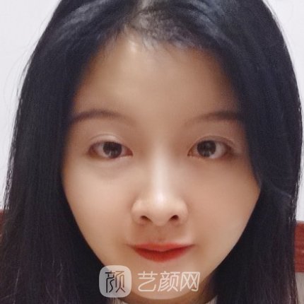 粤北人民医院整形科除皱抗衰实例展示|成果自然无痕