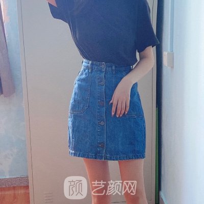 潍坊人民医院整形外科吸脂技术有保护吗？2023亲测实例上线