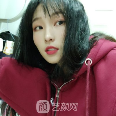 天津市第一中心医院整形技术好吗？2023隆鼻实例上线