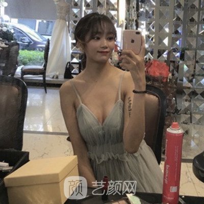 杭州清锴李保锴医生做鼻子有保护吗?全新体验实例分享