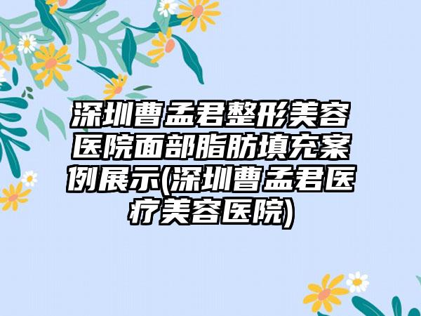 深圳曹孟君整形美容医院面部脂肪填充实例展示(深圳曹孟君医疗美容医院)