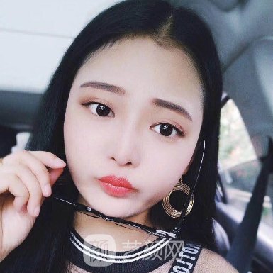 上海王会勇医生做鼻子好吗? 新体验实例公布