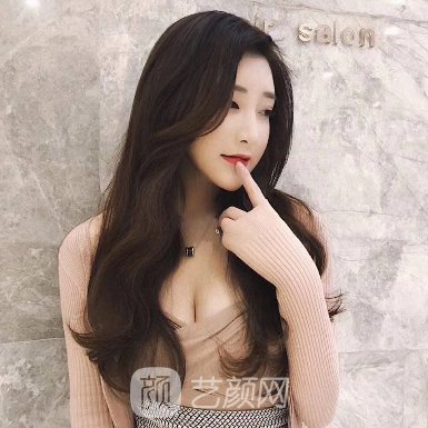 广州臻妍颂整形医院割双眼皮自然吗?90天变化细节一览