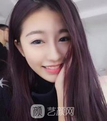 成都熹亚国际医疗美容正规吗？安好可靠吗？收费价格表