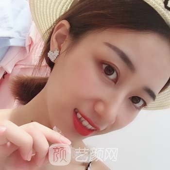 合肥滨湖医院口腔科怎么样？口碑好不好？种植牙实例