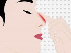 上海隆鼻修复有名医生有哪些？上海鼻综合口碑不错的医生测评