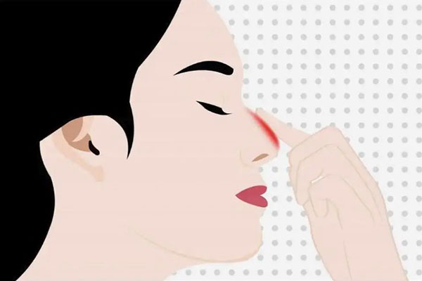 北医三院关于鼻子修复：唇裂鼻畸形再修复究竟是难在哪儿