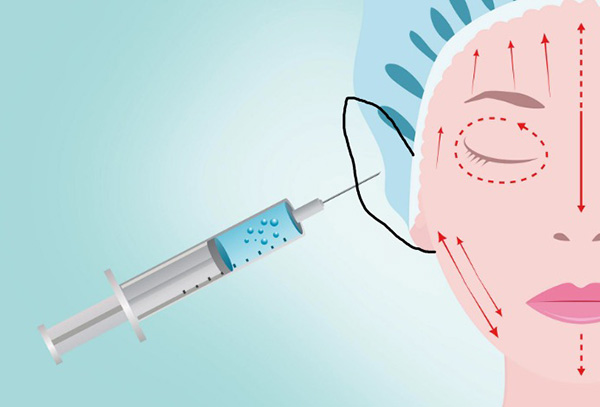 耳基底注射玻尿酸有风险吗？耳基底提升价格一般要多少钱