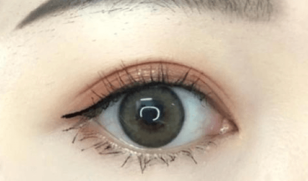 北京眼部整形多少钱？盘点北京实力医美医疗机构做眼整形的价格